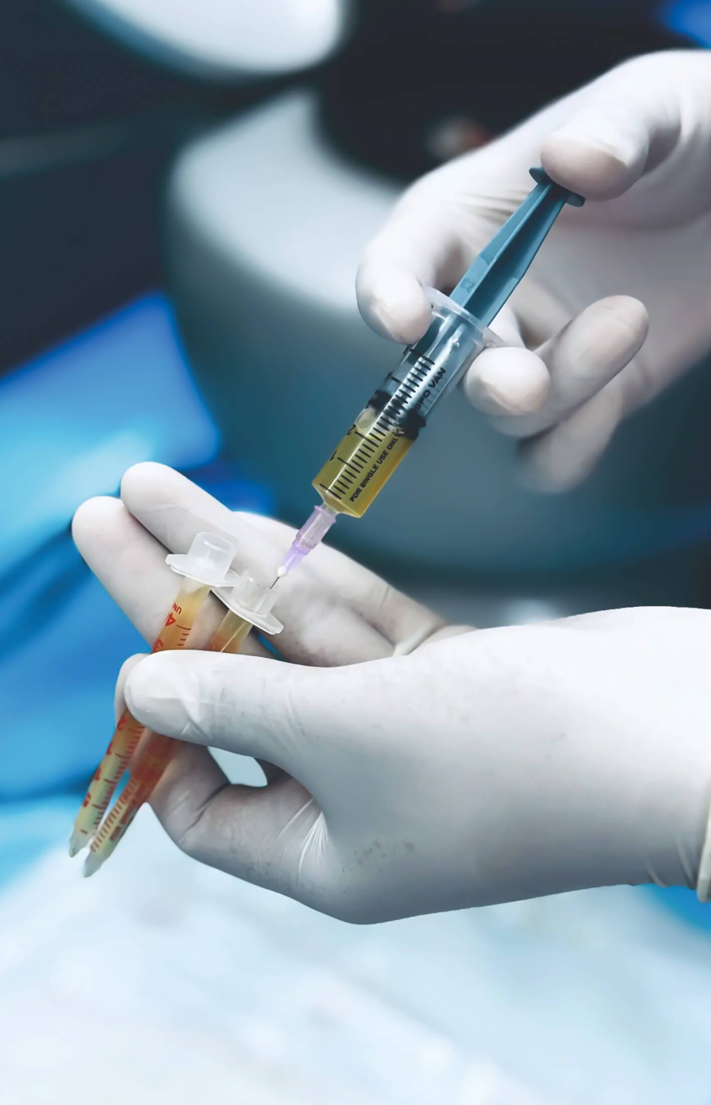 PRP treatment procedure